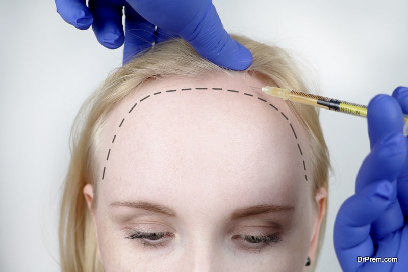 beautician doctor makes injections in the head of a woman for hair growth or to prevent baldness. Hair mesotherapy or hair transplant