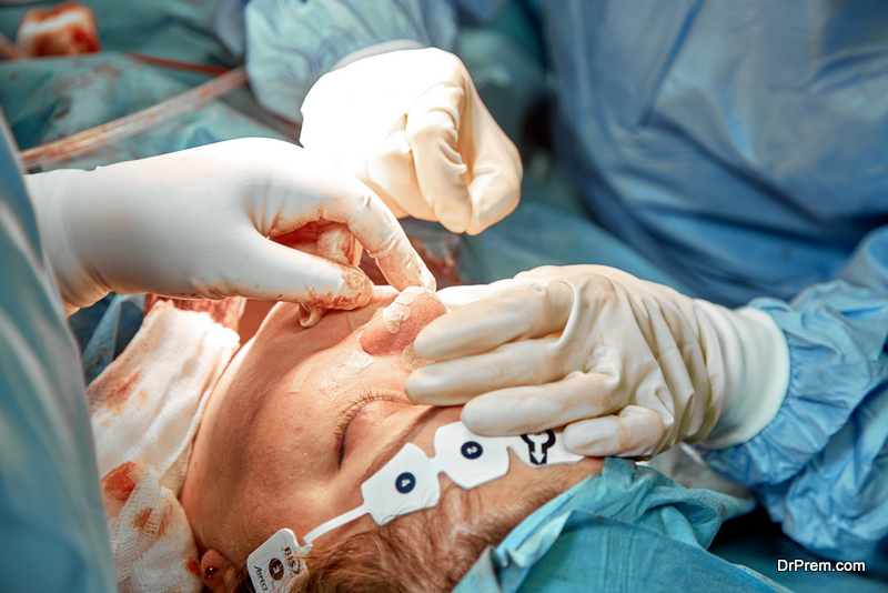 A surgeon with gloves is operating on his nose