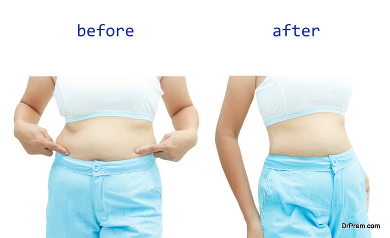 Woman's body before and after a diet