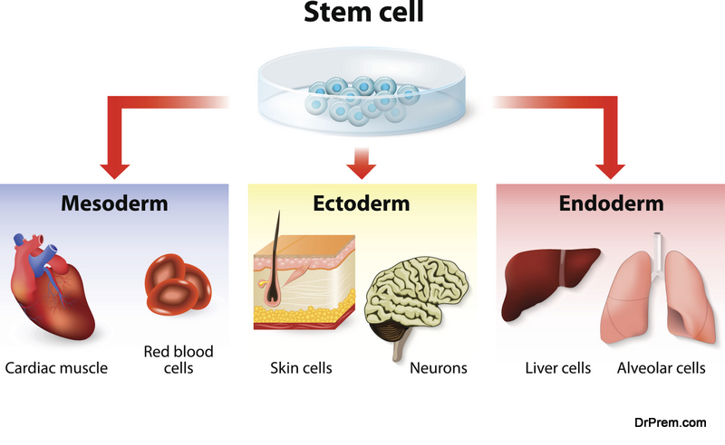 stem cell application