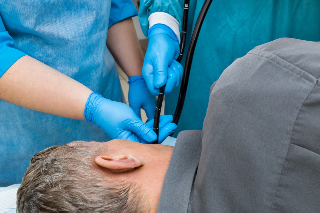 Esophagogastroduodenoscopy