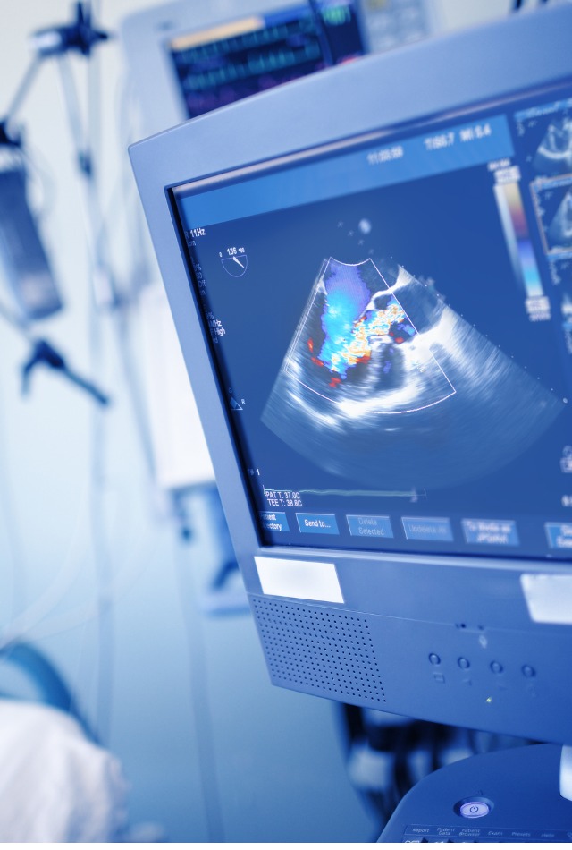 echocardiography