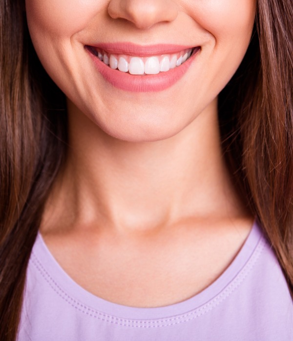 Prepless veneers