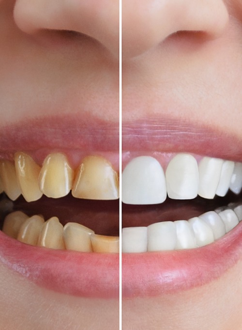 Cosmetic Dentistry