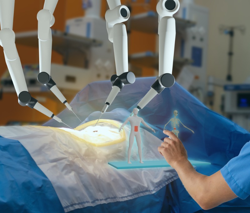 Robotic Surgery