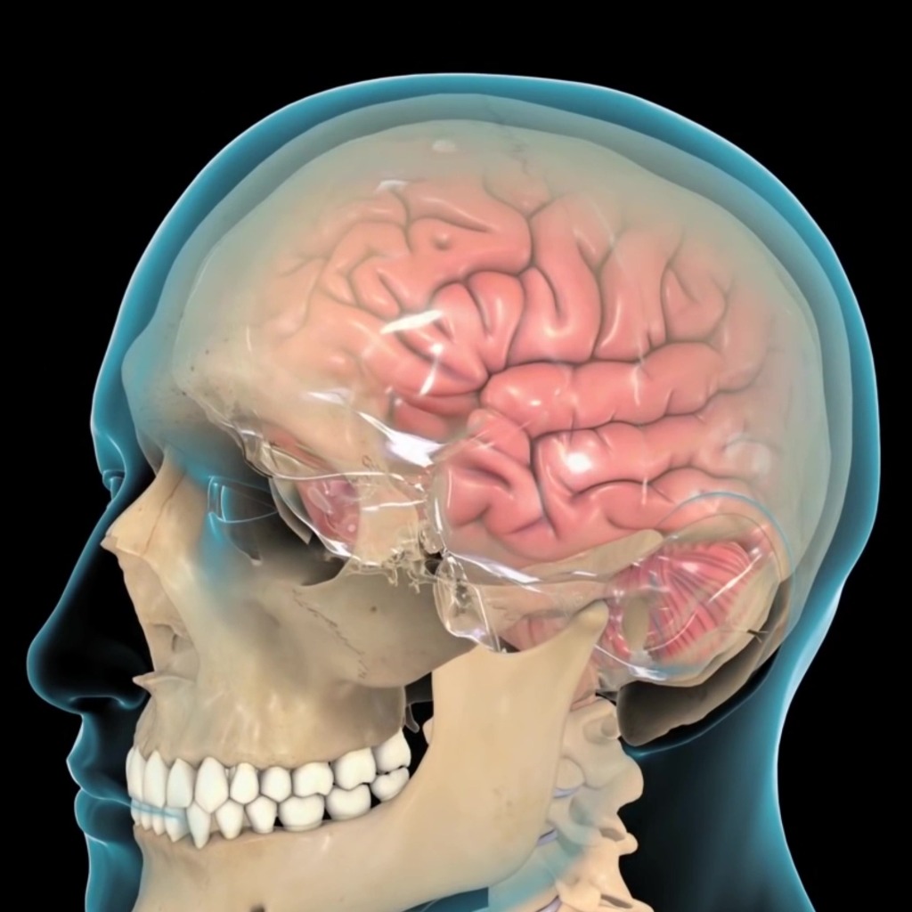 Craniotomy