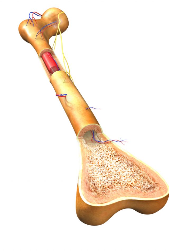 Bone Marrow Transplantation need