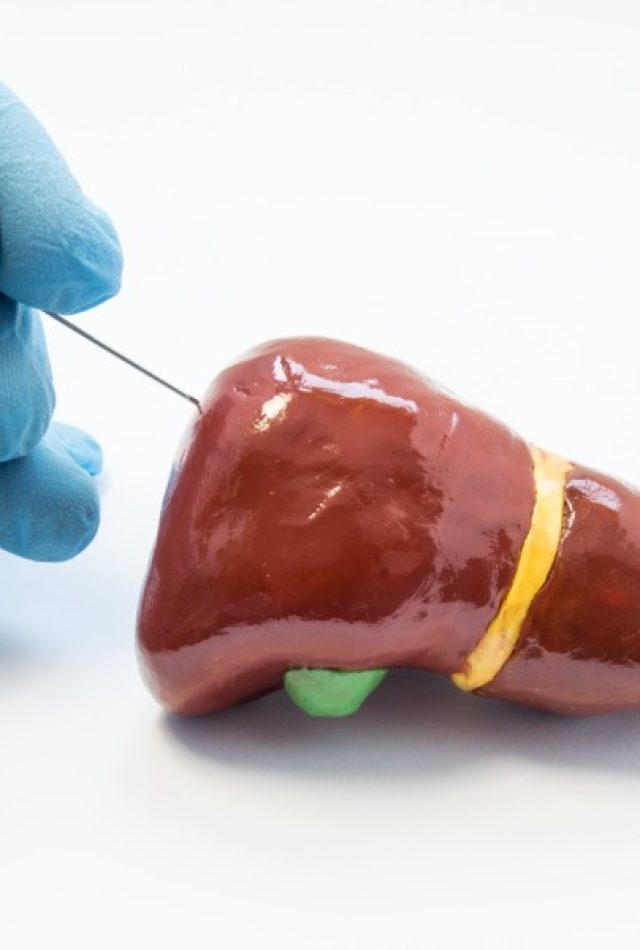 Combined Kidney and Liver transplant