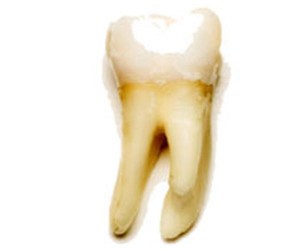 tooth-regeneration-gel-677099-