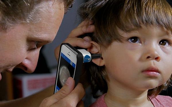 Cellscope for ear infections