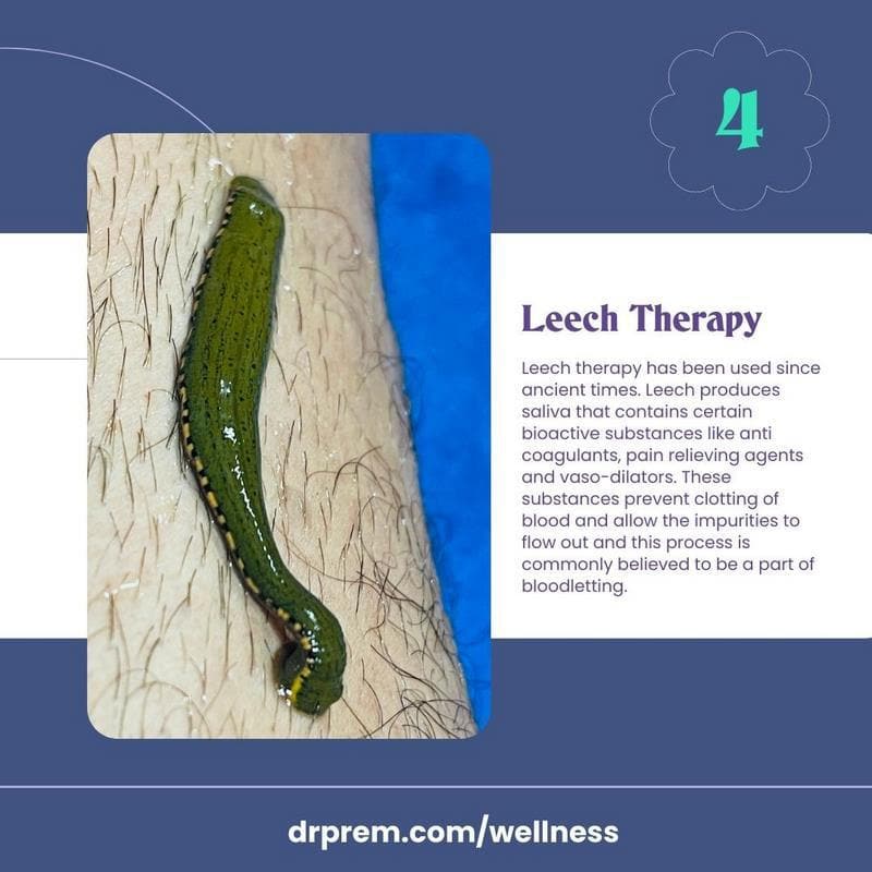 LEECH THERAPY