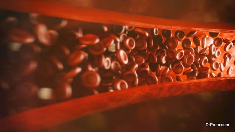 Blood Clots Alternative Medicine