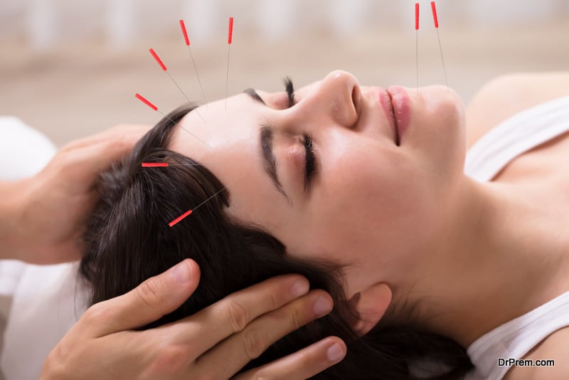 Health benefits of acupuncture