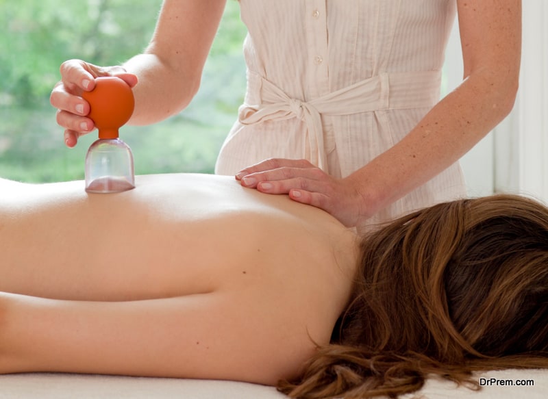 A young woman patient is being treated with cupping, an alternative medicine procedure