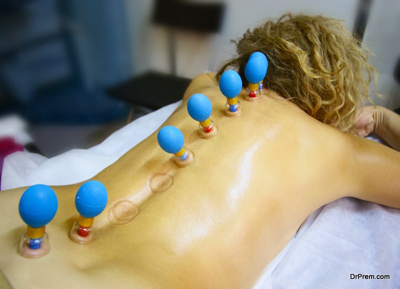 6 Things to Know About Cupping Therapy - Muscle & Fitness