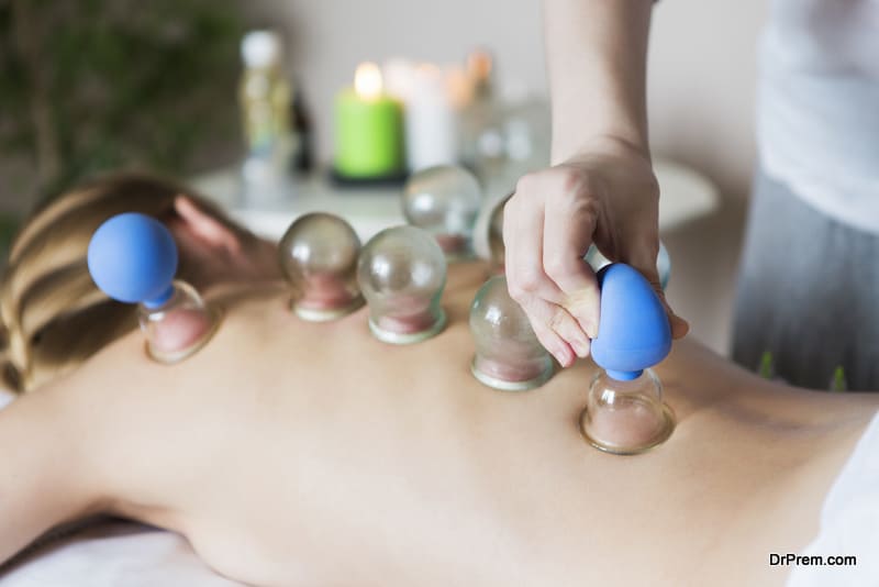 Young woman getting treatment at medical clinic. Fire cupping cups on back of female patient in Acupuncture therapy