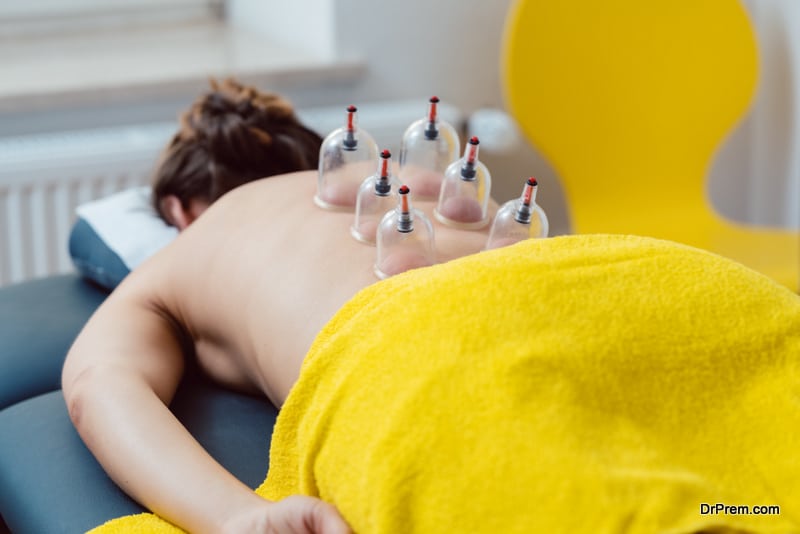 Session in the physical therapy with cupping on a woman patient