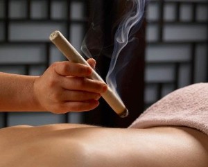 Westchester-Acupuncture-pole_moxibustion