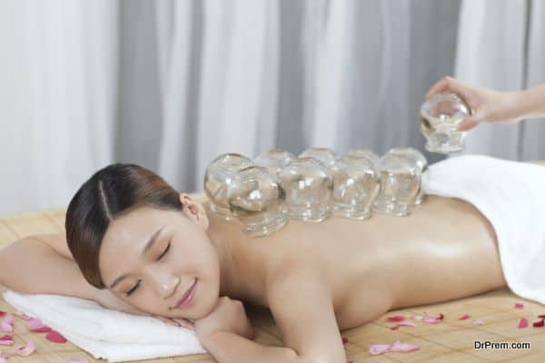 Young woman has Chinese medicine cupping on her back