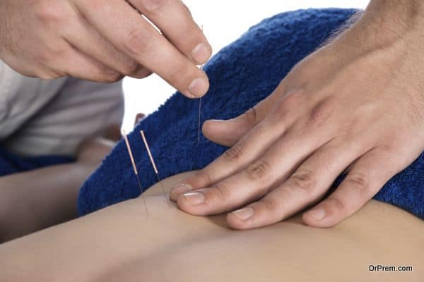 Physiotherapist doing Accupuncture 2