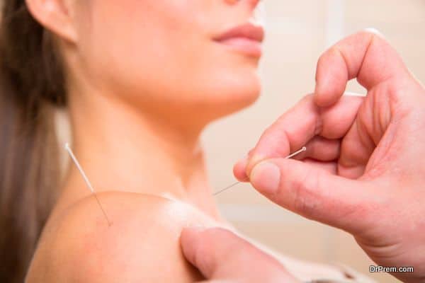 Doctor hands acupuncture needle pricking on woman