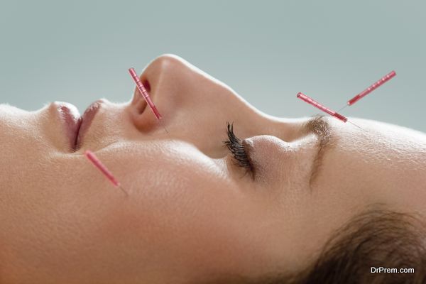 Facial acupuncture