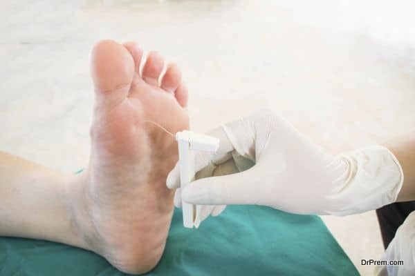 diabatic foot skining neuropathy