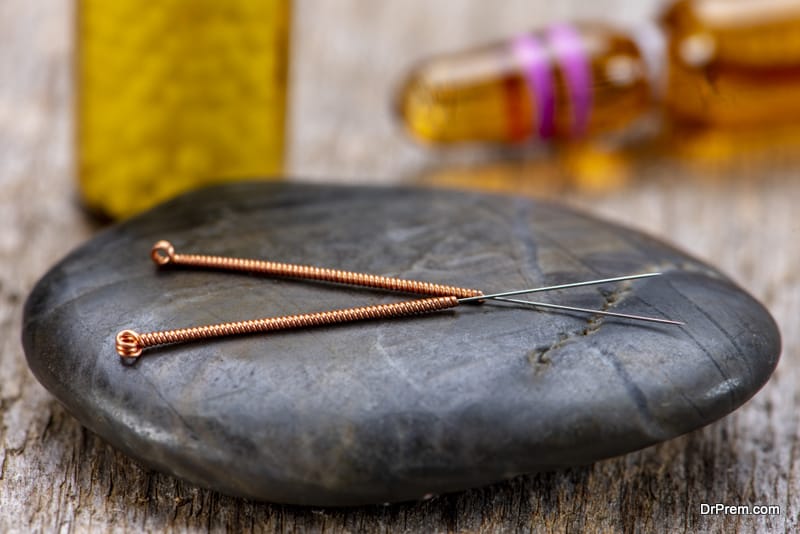 Alternative medicine with acupuncture