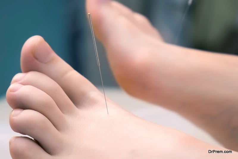 Man doctor acupuncturist in gloves inserts acupuncture needle to woman's feet