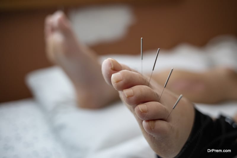 Traditional Chinese Medical Acupuncture Treatment 