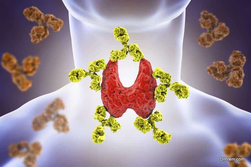 dissolve thyroid nodules naturally