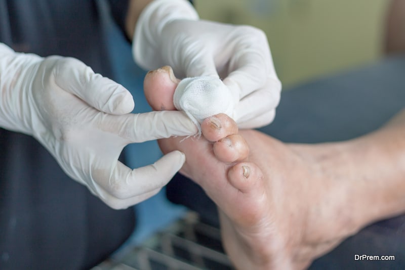 Diabetic foot