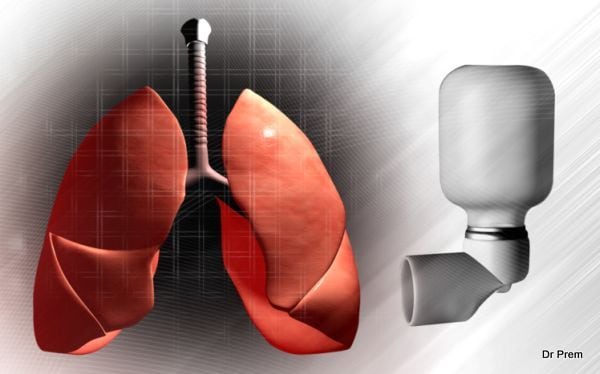Control Asthma by Lifestyle Modification