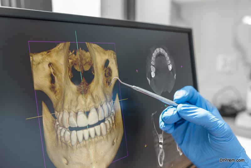 Dental-consultation-in-clinic.-Dentist-showing-3D-tomography-image-on-screen